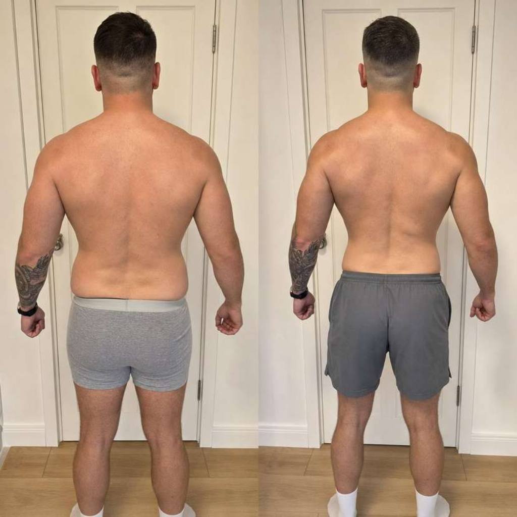JAMIE, 31 before and after
