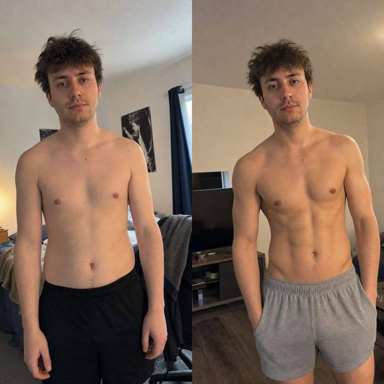 Liam before and after