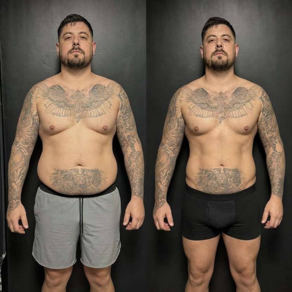 RICKY, 37 before and after