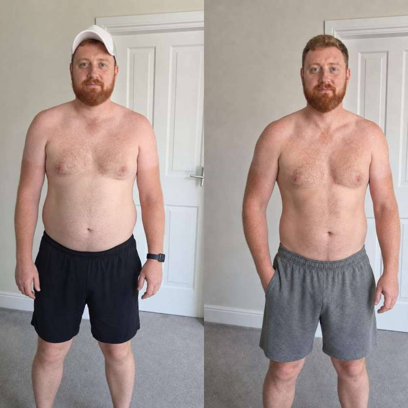 Rory before and after