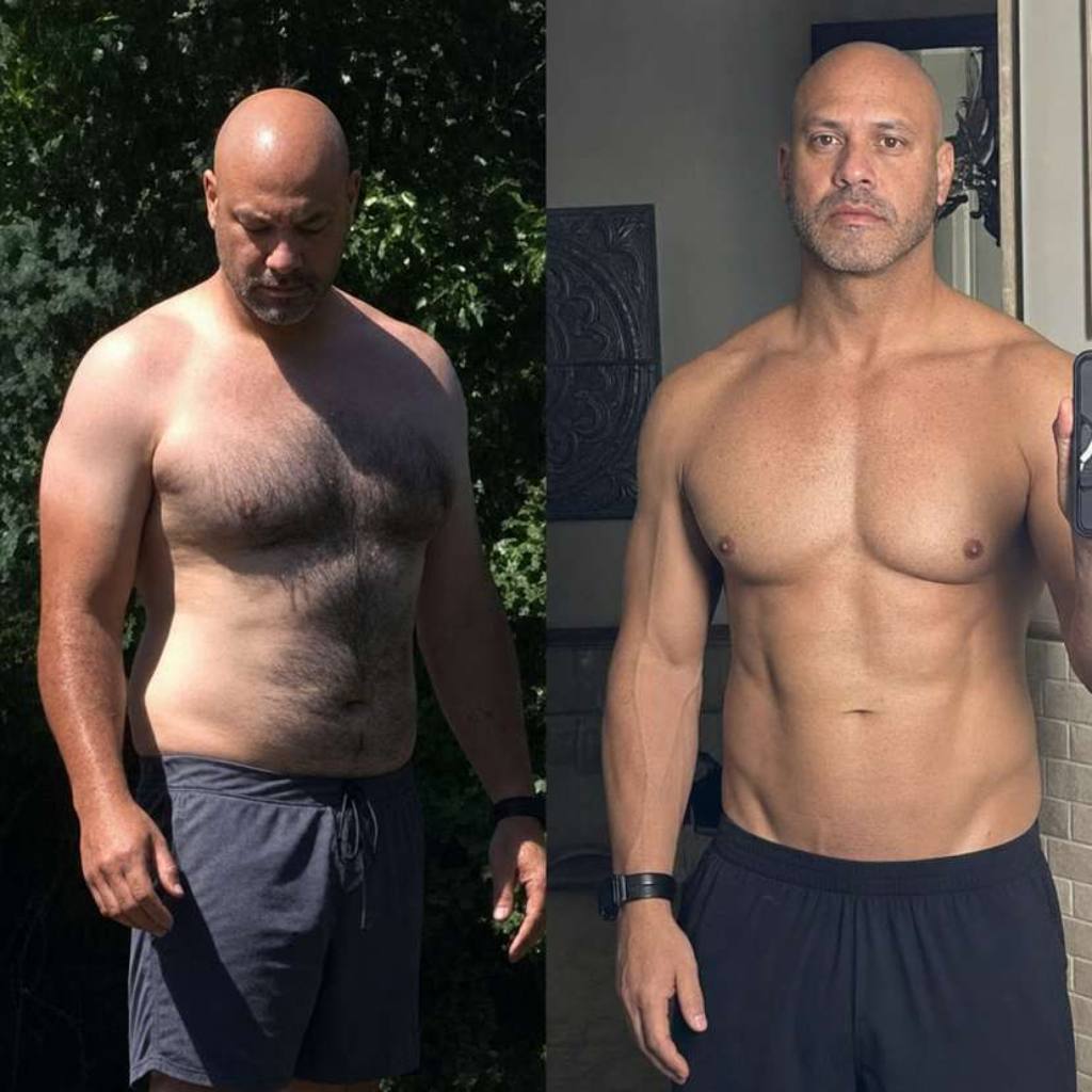 VINCENT, 50 before and after